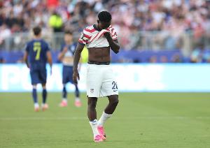 哥伦比亚vs法国直播_无插件在线免费观看